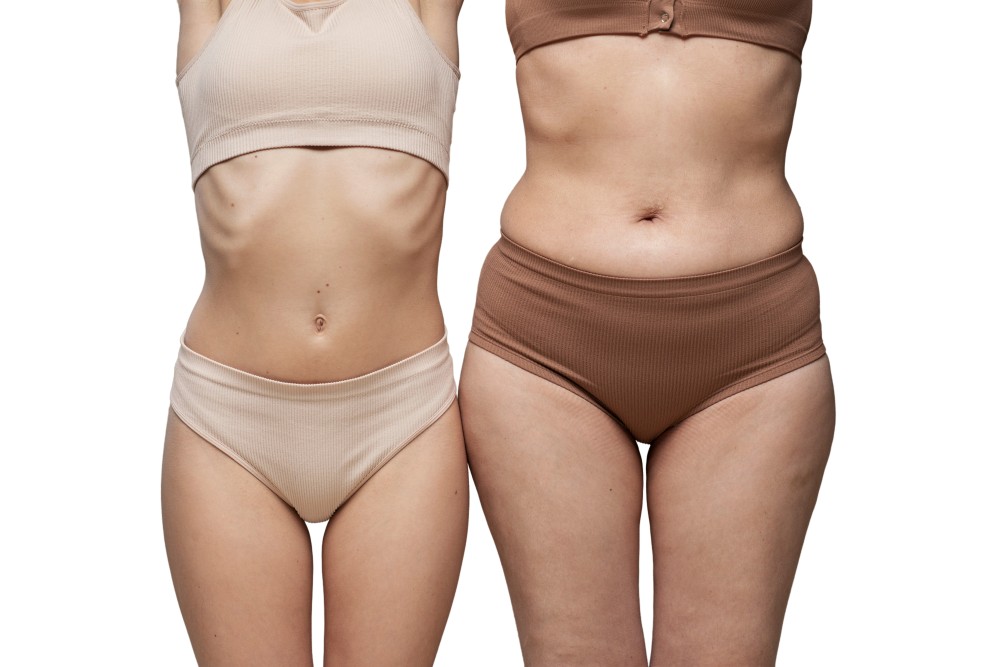 Body Contouring Before and After
