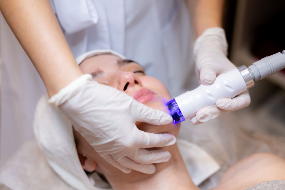 Facial Laser Treatment