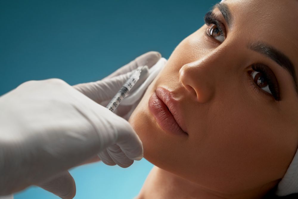 Radiesse Filler