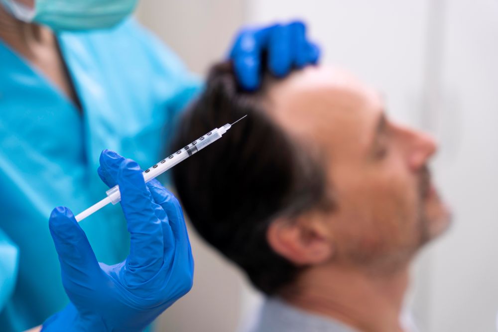 PRP for Hair Loss