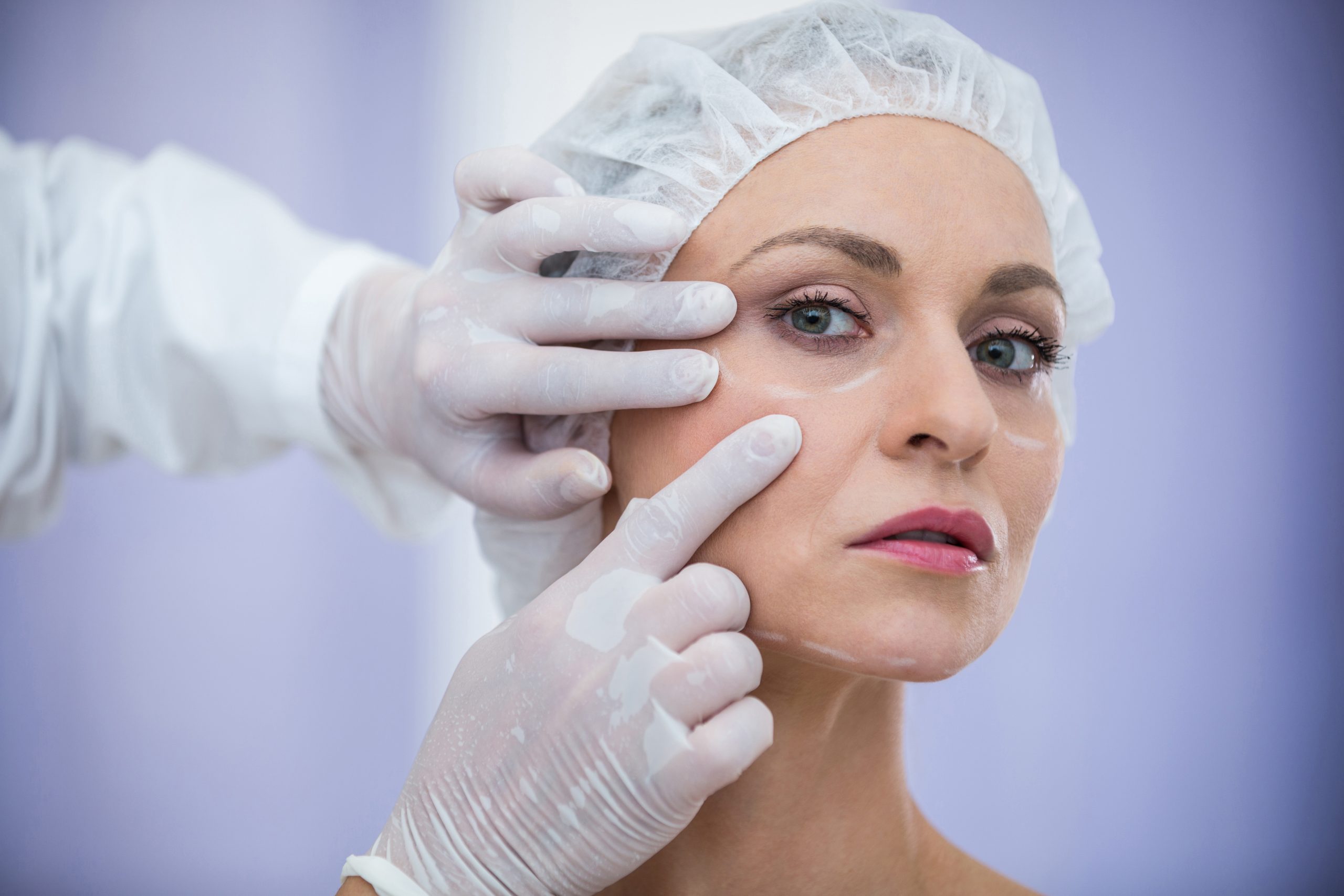Botox Treatment